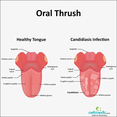 throst|Thrust